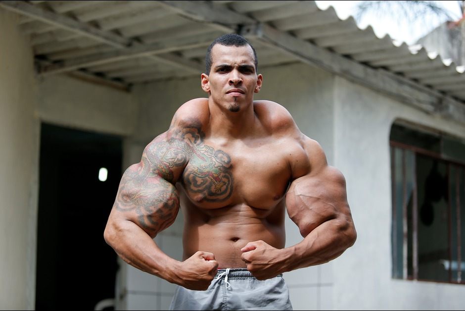 Ce Bodybuilder A Risque Sa Vie Pour Devenir L Homme Le Plus Muscle Du Monde